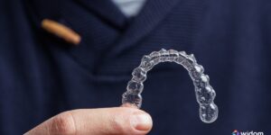 Função do ASB na Odontologia Estética | Widom