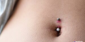 Qual a diferença entre Quelóide e Granuloma - O Guia Para Body Piercers | Widom