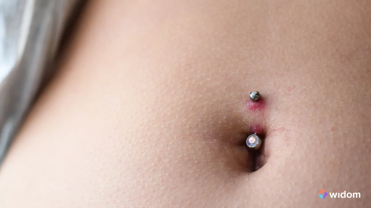 Qual a diferença entre Quelóide e Granuloma - O Guia Para Body Piercers | Widom
