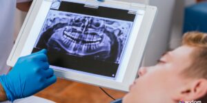 Técnicas de Radiologia Odontológica Para ASB - Auxiliar de Saúde Bucal | Widom
