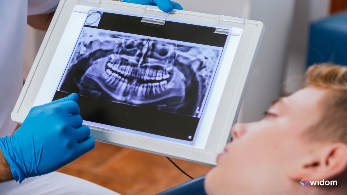 Técnicas de Radiologia Odontológica Para ASB - Auxiliar de Saúde Bucal | Widom
