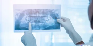 O que é Radiologia Odontológica | Widom ASB