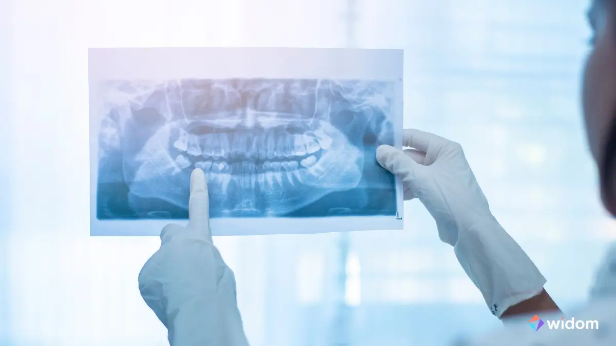 O que é Radiologia Odontológica | Widom ASB